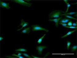 OAS1 Antibody, Novus Biologicals 0.1 mg | Buy Online | Novus Biologicals | Fisher Scientific