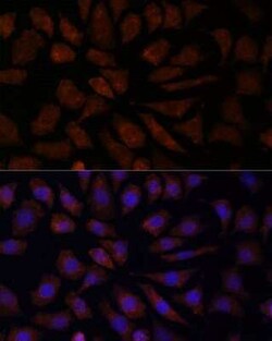 OAS3 Antibody - Azide and BSA Free, Novus Biologicals 0.02 mL; Unconjugated:Antibodies,