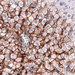 OATP1B3/SLCO1B3/OATP8 Antibody (CL3770), Novus Biologicals:Antibodies:Primary