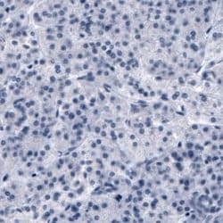 OATP1B3/SLCO1B3/OATP8 Antibody (CL3770), Novus Biologicals:Antibodies:Primary