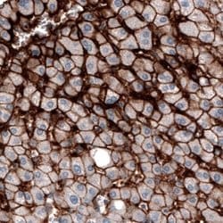 OATP1B3/SLCO1B3/OATP8 Antibody (CL3771), Novus Biologicals:Antibodies:Primary