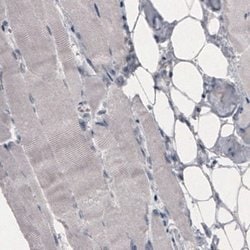 OATP1B3/SLCO1B3/OATP8 Antibody (CL3771), Novus Biologicals:Antibodies:Primary