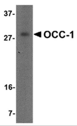 OCC1 Antibody - BSA Free, Novus Biologicals 0.1 mg | Buy Online | Novus Biologicals | Fisher Scientific