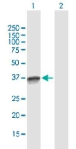 OCIAD1 Antibody, Novus Biologicals 0.05 mg | Buy Online | Novus Biologicals | Fisher Scientific