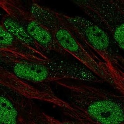 OCT2 Antibody, Novus Biologicals:Antibodies:Primary Antibodies