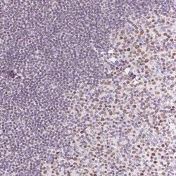 OCT2 Antibody, Novus Biologicals 0.1 mL | Buy Online | Novus Biologicals | Fisher Scientific