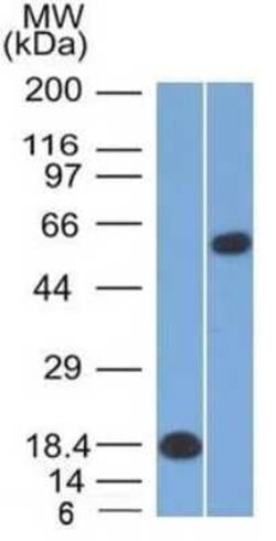 OCT2 Antibody (OCT2/2137), Novus Biologicals 100 &mu;g; Unconjugated:Antibodies,