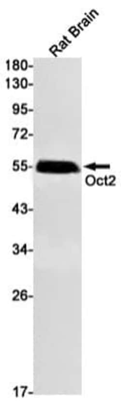 OCT2 Antibody (S07-8H6), Novus Biologicals 100 &mu;g; Unconjugated:Antibodies,