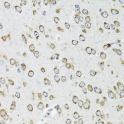 OGDH Antibody - BSA Free, Novus Biologicals:Antibodies:Primary Antibodies