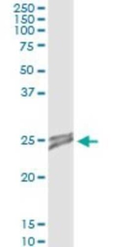 OIP5 Antibody (3G10-1D5), Novus Biologicals 0.1 mg | Buy Online | Novus Biologicals | Fisher Scientific