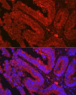 OLFM4 Antibody - Azide and BSA Free, Novus Biologicals 0.1 mL; Unconjugated:Antibodies,