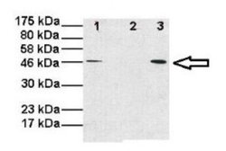 OMA1 Antibody, Novus Biologicals OMA1 Antibody; Unconjugated; 100 &mu;L:Antikroppar