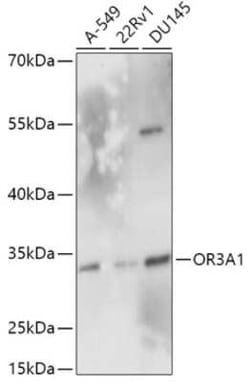 OR3A1 Antibody - Azide and BSA Free, Novus Biologicals 0.02 mL; Unconjugated:Anticuerpos