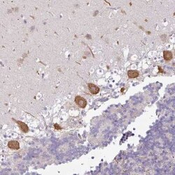 OR52D1 Antibody, Novus Biologicals:Antibodies:Primary Antibodies