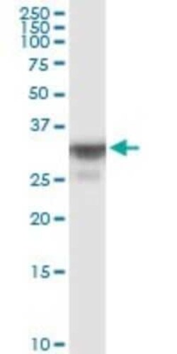 OR8B8 Antibody, Novus Biologicals 50 &mu;g | Buy Online | Novus Biologicals | Fisher Scientific