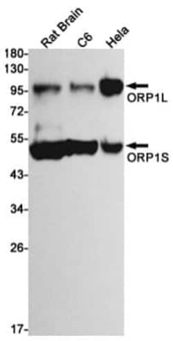 ORP1 Antibody (S02-2E2), Novus Biologicals 50 &mu;g; Unconjugated:Antibodies,