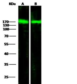 ORP150/HSP12A Rabbit anti-Human, Clone: 201, Novus Biologicals:Antibodies:Primary
