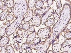 OS9 Antibody, Novus Biologicals 100 &mu;g, Unconjugated:Antibodies, Polyclonal