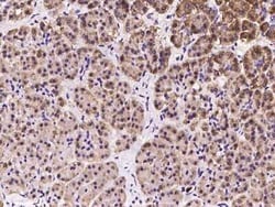 OS9 Antibody, Novus Biologicals 100 &mu;g, Unconjugated:Antibodies, Polyclonal