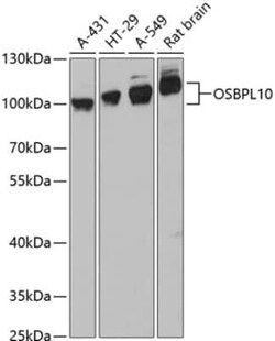 OSBPL10 Antibody - Azide and BSA Free, Novus Biologicals:Antibodies:Primary
