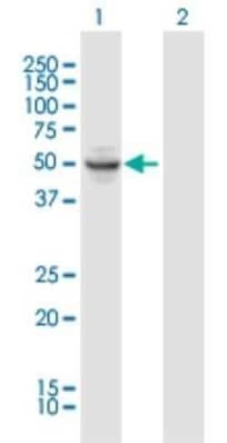 OSGIN1 Antibody, Novus Biologicals 0.05 mg, Unconjugated:Antibodies, Polyclonal