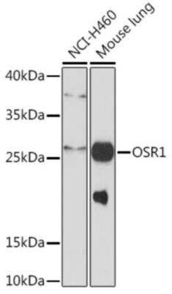 OSR1 Antibody - Azide and BSA Free, Novus Biologicals 0.02 mL; Unconjugated:Antibodies,