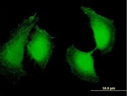 OSTF1 Antibody, Novus Biologicals 0.05 mg | Buy Online | Novus Biologicals | Fisher Scientific