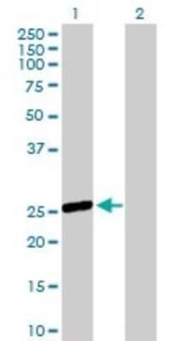 OSTF1 Antibody, Novus Biologicals 0.05 mg | Buy Online | Novus Biologicals | Fisher Scientific