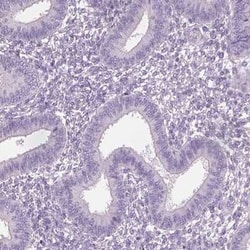 OTUD6A Antibody, Novus Biologicals:Antibodies:Primary Antibodies