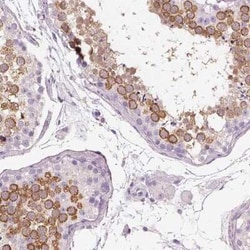 OTUD6A Antibody, Novus Biologicals:Antibodies:Primary Antibodies