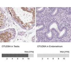 OTUD6A Antibody, Novus Biologicals:Antibodies:Primary Antibodies
