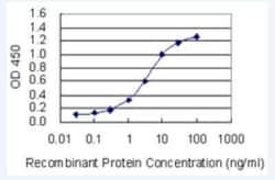 OTUD6B Antibody (3H4), Novus Biologicals 100 &mu;g | Buy Online | Novus Biologicals | Fisher Scientific