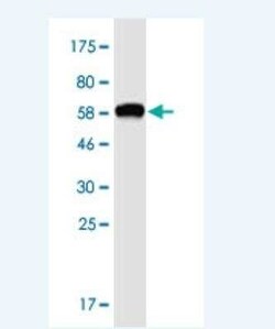 OTUD6B Antibody (3H4), Novus Biologicals 100 &mu;g | Buy Online | Novus Biologicals | Fisher Scientific