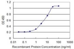 OTUD7B/Cezanne/ZA20D1 Antibody (2B4), Novus Biologicals 0.1 mg; Unconjugated:Antibodies,