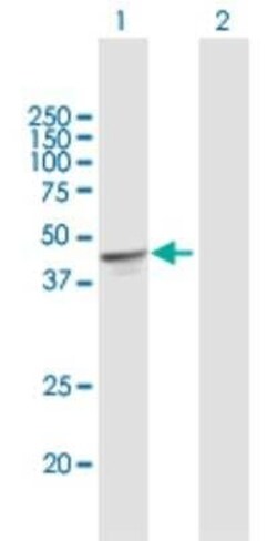 OXA1L Antibody, Novus Biologicals 0.05 mg | Buy Online | Novus Biologicals | Fisher Scientific