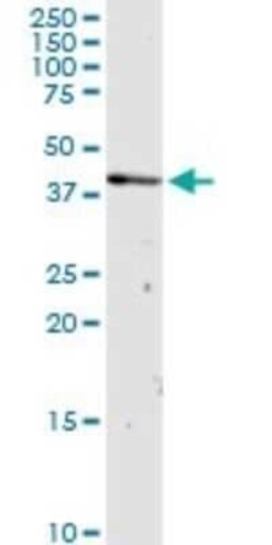 OXA1L Antibody, Novus Biologicals 0.1 mg | Buy Online | Novus Biologicals | Fisher Scientific
