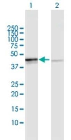 OXA1L Antibody, Novus Biologicals 0.1 mg | Buy Online | Novus Biologicals | Fisher Scientific