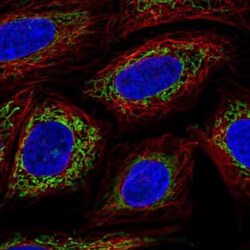 OXCT1 Antibody, Novus Biologicals 25 &mu;L, Unconjugated:Antibodies, Polyclonal