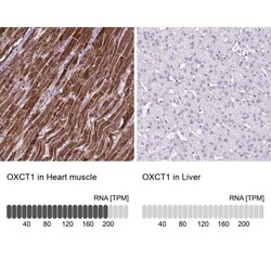 OXCT1 Antibody, Novus Biologicals 25 &mu;L, Unconjugated:Antibodies, Polyclonal
