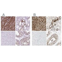 OXCT1 Antibody, Novus Biologicals 25 &mu;L, Unconjugated:Antibodies, Polyclonal