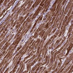 OXCT1 Antibody, Novus Biologicals 25 &mu;L, Unconjugated:Antibodies, Polyclonal
