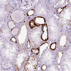 OXCT1 Antibody, Novus Biologicals 25 &mu;L, Unconjugated:Antibodies, Polyclonal