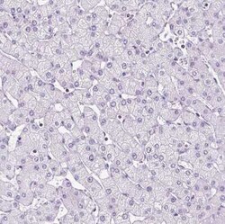 OXCT1 Antibody, Novus Biologicals 25 &mu;L, Unconjugated:Antibodies, Polyclonal