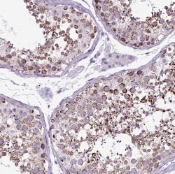 OXCT1 Antibody, Novus Biologicals 25 &mu;L, Unconjugated:Antibodies, Polyclonal