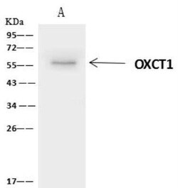 OXCT1 Antibody, Novus Biologicals 50 &mu;g, Unconjugated:Antibodies, Polyclonal