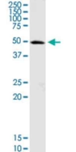 OXCT1 Antibody, Novus Biologicals 0.1 mg | Buy Online | Novus Biologicals | Fisher Scientific