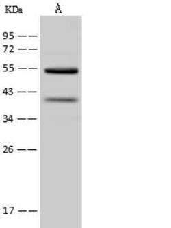 OXCT1 Antibody, Novus Biologicals 50 &mu;g, Unconjugated:Antibodies, Polyclonal