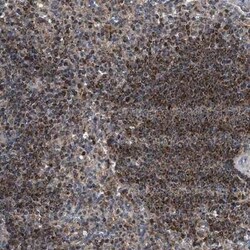 OXSM Antibody, Novus Biologicals 0.1 mL | Buy Online | Novus Biologicals | Fisher Scientific