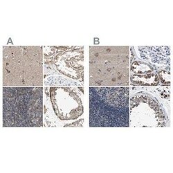 OXSM Antibody, Novus Biologicals 0.1 mL | Buy Online | Novus Biologicals | Fisher Scientific