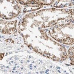 OXSM Antibody, Novus Biologicals 0.1 mL | Buy Online | Novus Biologicals | Fisher Scientific